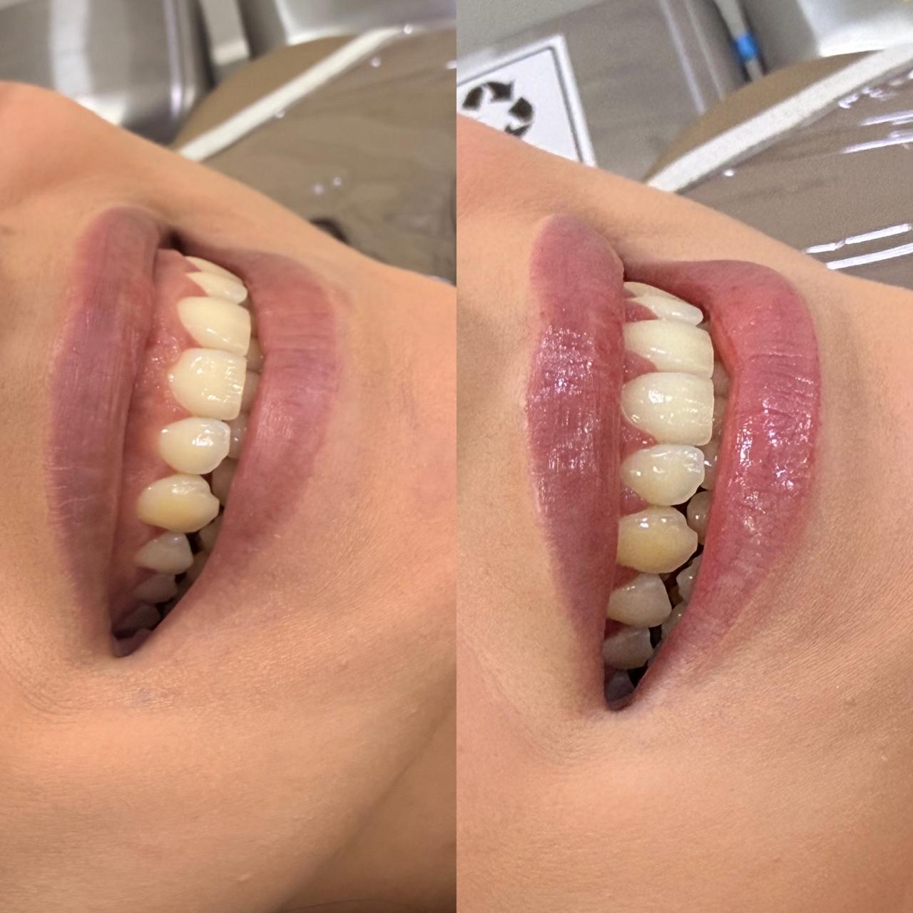 Sorriso harmonizado em close editorial
