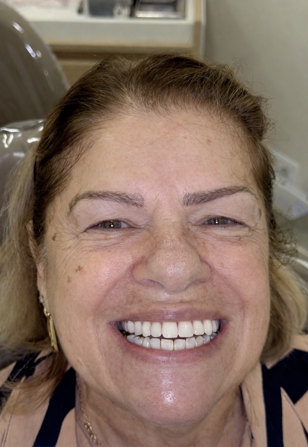 Paciente do Ateliê Orofacial